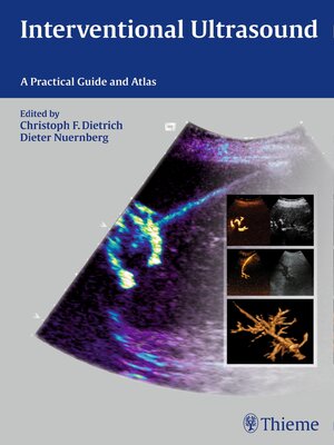 cover image of Interventional Ultrasound